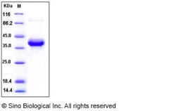Sino Biological Recombinant Human S100A4 Protein (hFc Tag), Quantity: Each