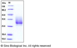 Sino Biological Recombinant Human CD147/Basigin/EMMPRIN Protein (His Tag),