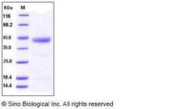 Sino Biological Human ESAM / Endothelial Cell Adhesion Molecule Protein