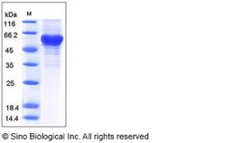 Sino Biological Recombinant Human Ephrin A3 Protein (hFc Tag), Quantity: