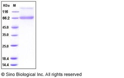 Sino Biological Recombinant Human Decorin Protein (hFc Tag), Quantity: