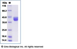 Sino Biological Recombinant Human Decorin Protein, Quantity: Each of 1