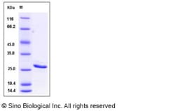 Sino Biological Recombinant Human Bcl-2 Protein (His Tag), Quantity: Each
