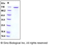 Sino Biological Recombinant Human EphB6 Protein (hFc Tag), HPLC-verified,