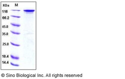 Sino Biological Recombinant Human HER3/ERBB3 Protein (ECD, hFc Tag), HPLC-verified,