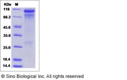 Sino Biological Human HER3 / ErbB3 Protein 200ug, Quantity: Each of 1