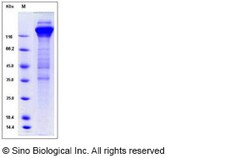 Sino Biological Human cytomegalovirus (HCMV) Glycoprotein B / gB Protein