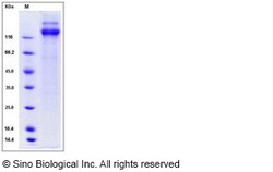 Sino Biological Human cytomegalovirus (HCMV) Glycoprotein B / gB Protein