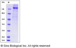 Sino Biological Human cytomegalovirus (HCMV) Glycoprotein B / gB Protein