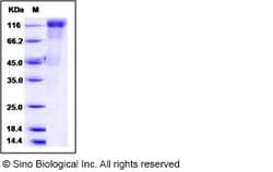 Sino Biological Human cytomegalovirus (HCMV) Glycoprotein B / gB Protein