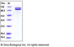 Sino Biological Human E-Cadherin / CDH1 / E-cad / CD324 Protein (His Tag)