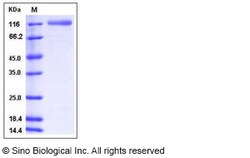 Sino Biological Recombinant Human ECE2 Protein (His Tag), Quantity: Each