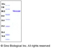 Sino Biological Human Layilin / LAYN Protein (Fc Tag) 100ug, Quantity: