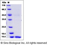 Sino Biological Recombinant Human Dectin-1/CLEC7A Protein, HPLC-verified,