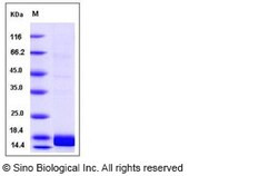 Sino Biological Human ALK-2 / ACVR1 / ALK2 Protein (His Tag) 100ug, Quantity: