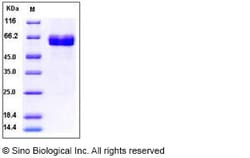 Sino Biological Human ACVR2B / ActivinR-IIB Protein (ECD, Fc Tag) 100ug,