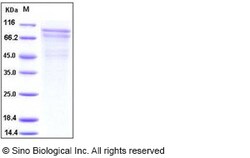 Sino Biological Recombinant Human R-Cadherin/CDH4 Protein (His Tag), Quantity: