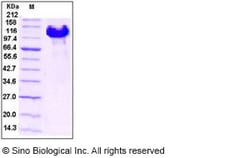 Sino Biological Recombinant Human EphB4 Protein (hFc Tag), Quantity: Each