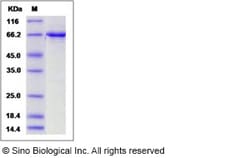 Sino Biological Human EphB4 / HTK Protein (aa 563-987, His & GST Tag) 50ug,