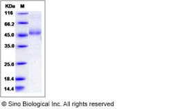 Sino Biological Recombinant Human MD1 Protein (hFc Tag), Quantity: Each