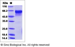 Sino Biological Recombinant Human methionyl aminopeptidase 2/METAP2 Protein