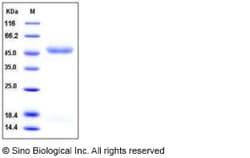 Sino Biological Human IL11RA / IL11Rα Protein (His Tag) 100ug, Quantity: