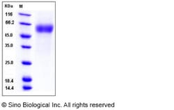 Sino Biological Human CD64 / FCGR1A Protein (His & AVI Tag), Biotinylated