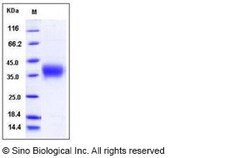 Sino Biological Recombinant Human ACVR2A Protein (His Tag), HPLC-verified,