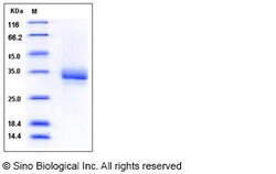 Sino Biological Human CD32b / FCGR2B Protein (His & AVI Tag), Biotinylated