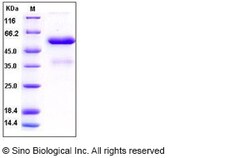 Sino Biological Recombinant Human FGF-9 Protein (hFc Tag), Quantity: Each