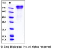 Sino Biological Recombinant Human OMGP Protein (aa 1-416, His Tag), HPLC-verified,