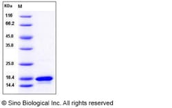 Sino Biological Human TNF-beta / TNFSF1 / Lymphotoxin alpha Protein 1mg,