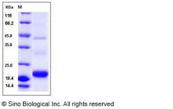 Sino Biological Recombinant Human PDGF-C Protein (His Tag), Quantity: Each