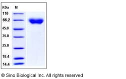 Sino Biological Human Axl Kinase Protein (ECD, His Tag) 100ug, Quantity: