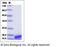 Sino Biological Human NTF3 / Neurotrophin 3 Protein 20ug, Quantity: Each