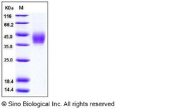 Sino Biological Human B7-DC / PD-L2 / CD273 Protein (His Tag) 100ug, Quantity: