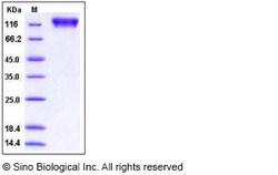 Sino Biological Human MERTK / Mer Protein (His & Fc Tag) 100ug, Quantity: