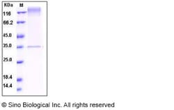 Sino Biological Recombinant Human Mer Protein, Quantity: Each of 1