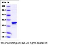 Sino Biological Recombinant Human Mer Protein (aa 578-872), Quantity: Each