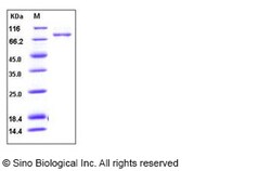 Sino Biological Human Periostin / POSTN Protein (His Tag) 100ug, Quantity: