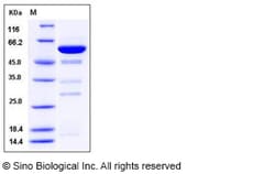 Sino Biological Human Galectin-8 / LGALS8 Protein (GST Tag) 100ug, Quantity: