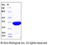 Sino Biological Human Galectin-8 / LGALS8 Protein 100ug, Quantity: Each