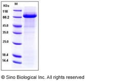 Sino Biological Recombinant Human Factor XI Protein (His Tag), HPLC-verified,