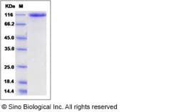 Sino Biological Human ROBO2 Protein (His Tag) 100ug, Quantity: Each of
