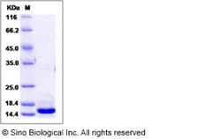 Sino Biological Human HMGB1 / HMG1 Protein (His Tag) 50ug, Quantity: Each