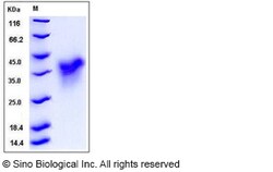 Sino Biological Human HVEM / TNFRSF14 Protein (His Tag) 100ug, Quantity: