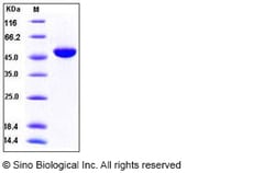 Sino Biological Recombinant Human Interferon alpha 4/IFNA4 Protein (hFc