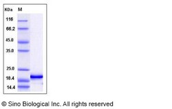 Sino Biological Recombinant Human Interferon alpha 4/IFNA4 Protein (His