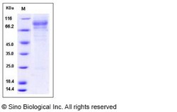 Sino Biological Recombinant Human Iduronate 2 sulfatase/IDS Protein (His