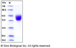 Sino Biological Recombinant Human IFNGR1 Protein (His Tag), HPLC-verified,